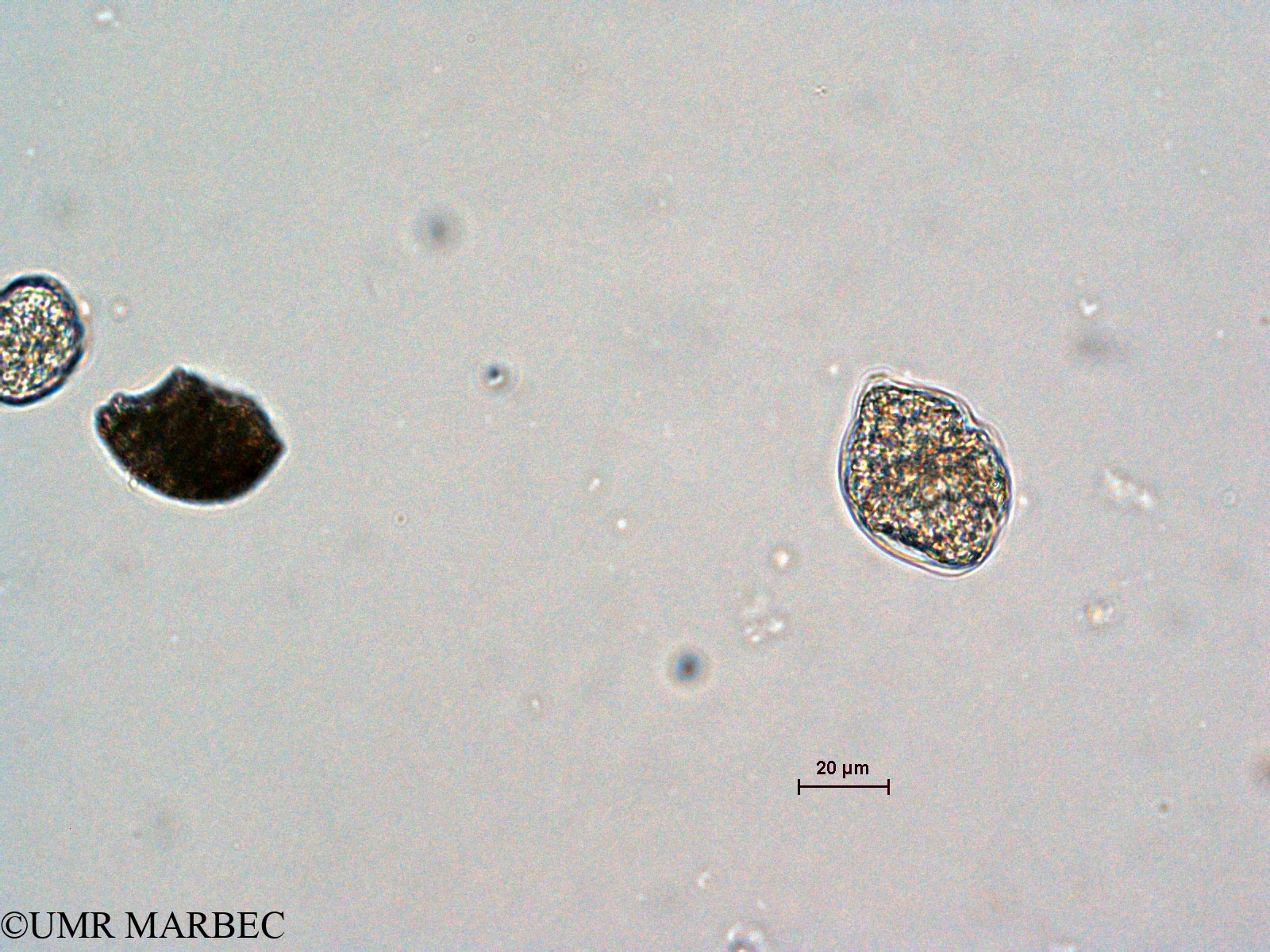 phyto/Scattered_Islands/all/COMMA April 2011/Gyrodinium sp2 (ancien Gyrodinium sp1 -3)(copy).jpg